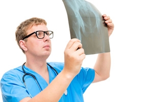 Change your Lifestyle to Prevent Hip Fractures and Injuries