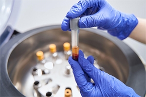 PRP and Regenerative Options for Sports Injuries