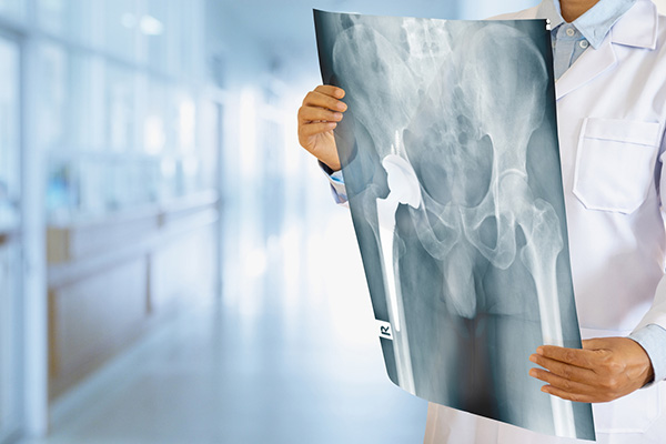 When You Should See an Orthopedic Specialist
